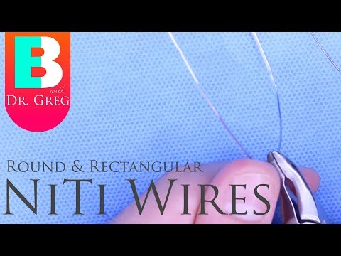 download lagu mp3 mp4 Niti Wires In Orthodontics, download lagu Niti Wires In Orthodontics gratis, unduh video klip Niti Wires In Orthodontics