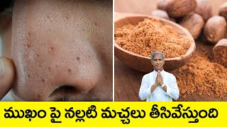 Blackheads on Nose | How to Get Rid of Blackheads on Your Nose | Dr Manthena Satyanarayana Raju