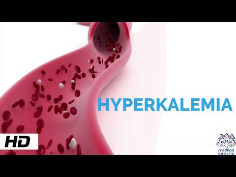 HYPERKALEMIA, Causes, Signs and Symptoms, Diagnosis and Treatment.