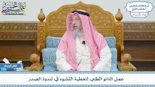 2195 - عمل التاتو الطبي لتغطية التشوه في ثندوة الصدر - عثمان الخميس