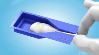 ProPoint PT- How to obturate a root canal with SmartSeal