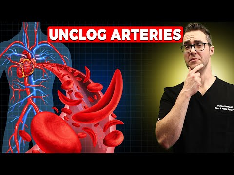 , title : '29 WORST Heart & Artery Foods To Avoid [🔄 REVERSE Clogged Arteries!]'