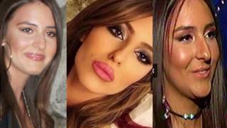 ANASTASIJA Ražnatović  PRE I POSLE