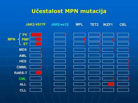 5  Mijeloproliferativne neoplazme prof dr Mirjana Gotić   Hronična mijeloidna leukemija i