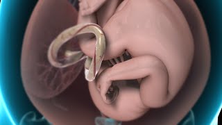 Amniocentesis (Amniotic Fluid Test)