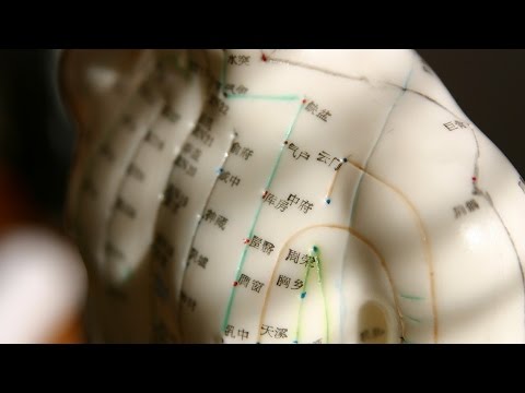 akupunktúrás pontok felállítása