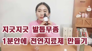 지긋지긋 발톱무좀 벗어나는 천연치료제 1분안에 만들기