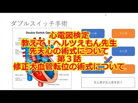 大血管の転位 - 定義