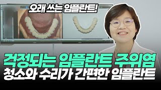 임플란트 주위염이 걱정되신다고요? 집에서 청소가 가능한 코너스 임플란트! (실제 사례, 장단점 소개)