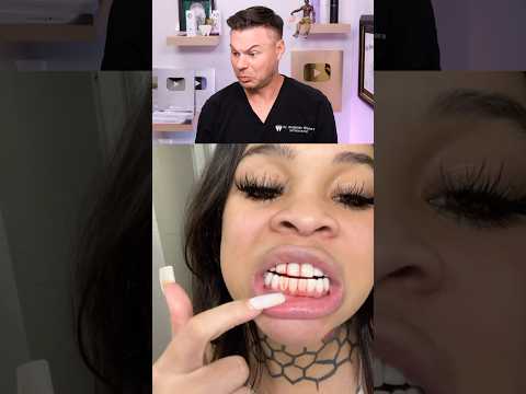 Dentist Reveals If Bleeding Gums Is Normal! 😭🦷