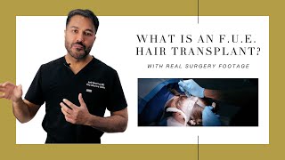 Canadian Hair Transplant Centre