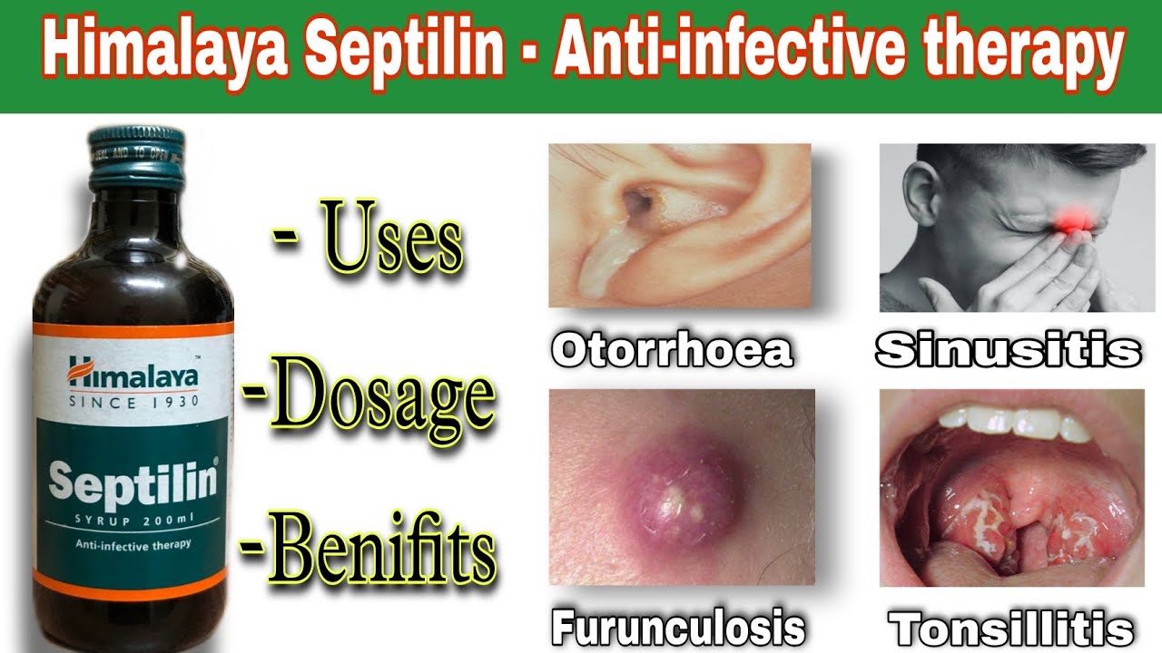 Watch video Septilin Himalaya Uses in hindi | इम्यूनिटी बढ़ाने की दवाई | Tonsillitis | Sinusitis Now Septilin Himalaya Uses in hindi | इम्यूनिटी बढ़ाने की दवाई | Tonsillitis | Sinusitis
