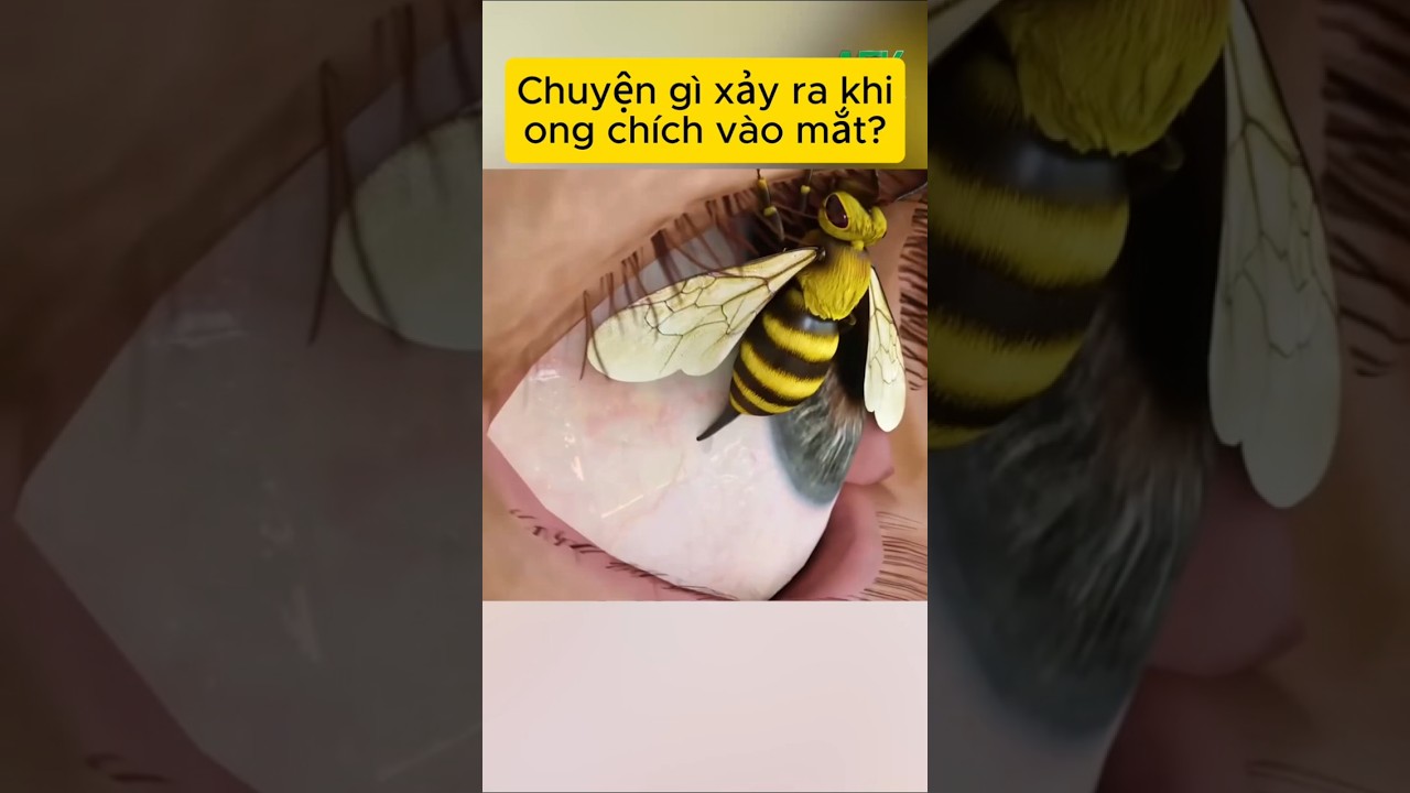 Chuyện gì xảy ra khi bạn bị ong chích vào mắt?