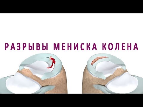 Врач который лечит заболевания суставов Боль в спине жжение ниже поясницы