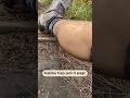 Frequent Calf Muscle Cramps Here Are 3 Ways To Deal With Them Youtubehealth Doctor Viral