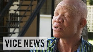 Albino Activism in Tanzania: VICE News Meets Josephat Torner