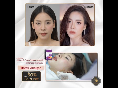 โบท็อก ที่ไหนดี