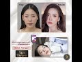 โบท็อก ที่ไหนดี