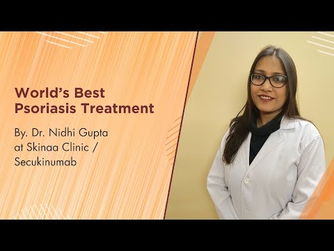 Scapho Secukinumab 150 Mg Injection (1 Prefilled Syringe)