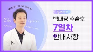 백내장 수술 7일차의 안내사항은?