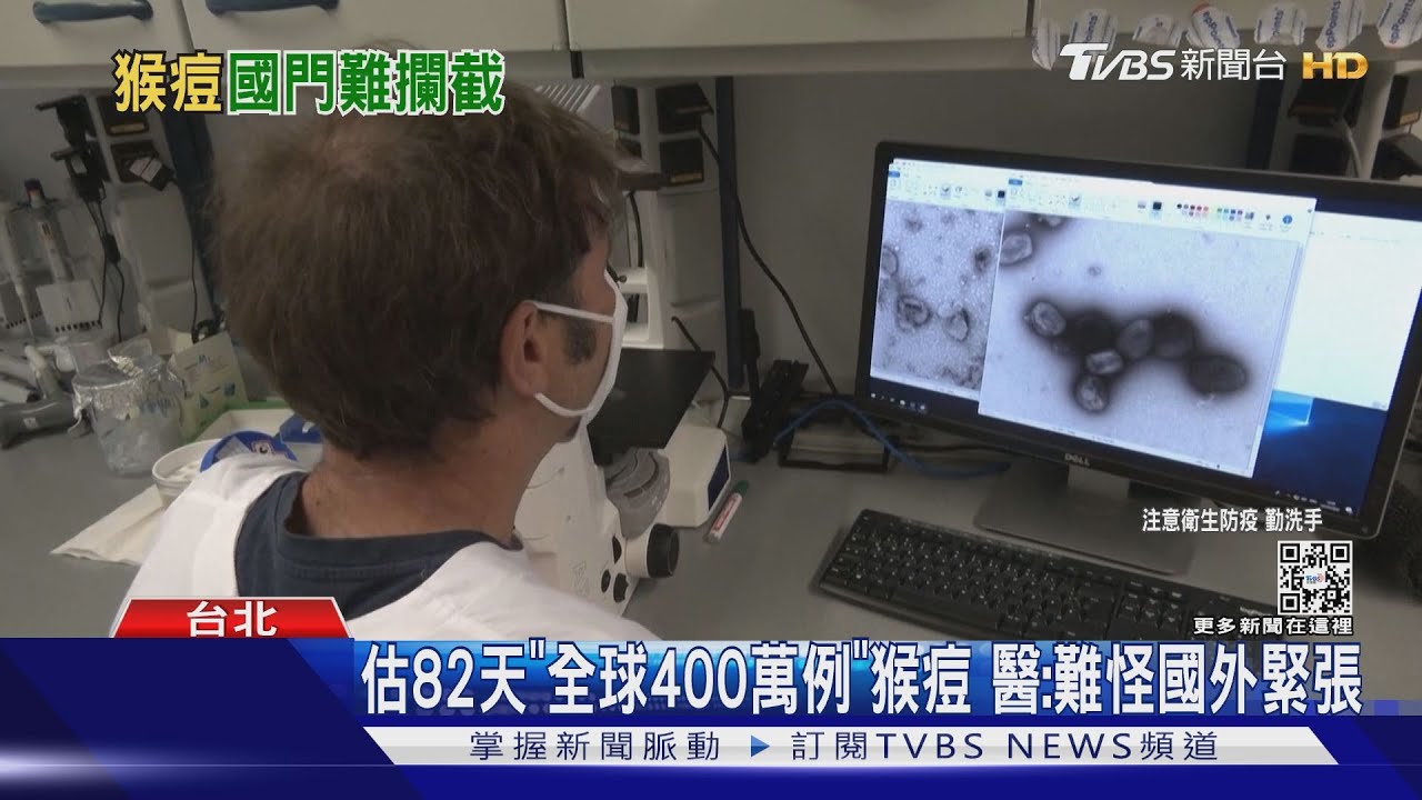 猴痘加速突變12倍 「無快篩」靠PCR機場難攔