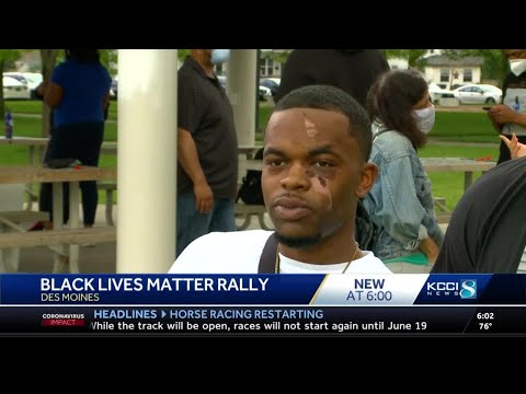 Black Lives Matter rally asks for justice for man assaulted last week