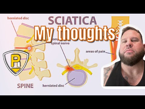 Your sciatic nerve pain is coming from your BACK! (MOST LIKELY) Stop stretching!