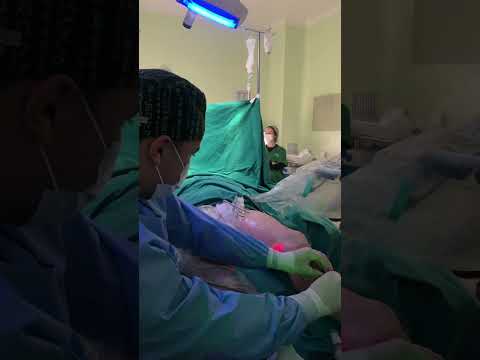 Halison Vilacorta Araújo De Sousa-13
