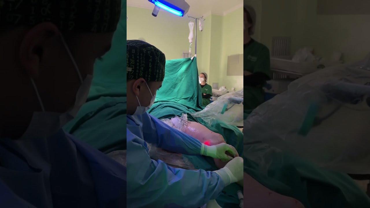 Halison Vilacorta Araújo De Sousa-13