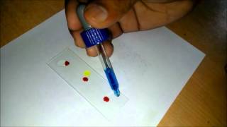 How To Test Your Own Blood Groups ?