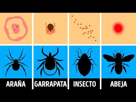 Cómo identificar una picadura de insecto y qué hacer con ella