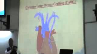 Dr Mohsen CVS 4 10 12 2014