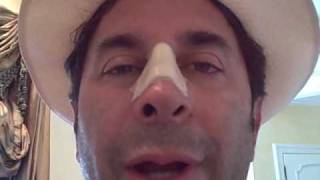 Dr. Paul Nassif — Nasal Injury Journal Day 3