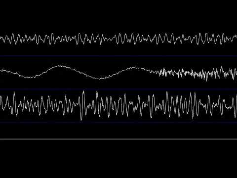 Azazel - fractured.ni (Amiga) [Oscilloscope View]