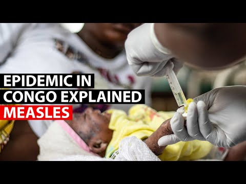 Explained: The world’s largest measles outbreak