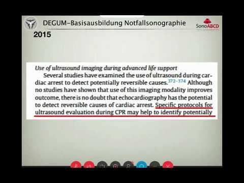 C-Probleme: Einführung FEEL. Webinar von Daniel Kiefl