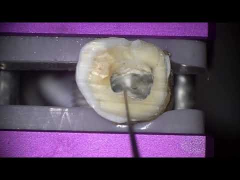 sword and spoon resistance test