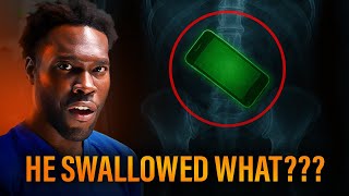 The Craziest Foreign Objects Found in Human Bodies | Critical Encounters