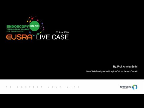 EUSRA Live Case From Endoscopy On Air By  Prof  Amrita Sethi