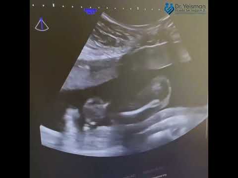 Tamizaje neonatal Barranquilla con el ginecólogo y obstetra Yeisman Pineda