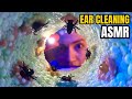 ASMR👂Cleaning Your Ear so Relax