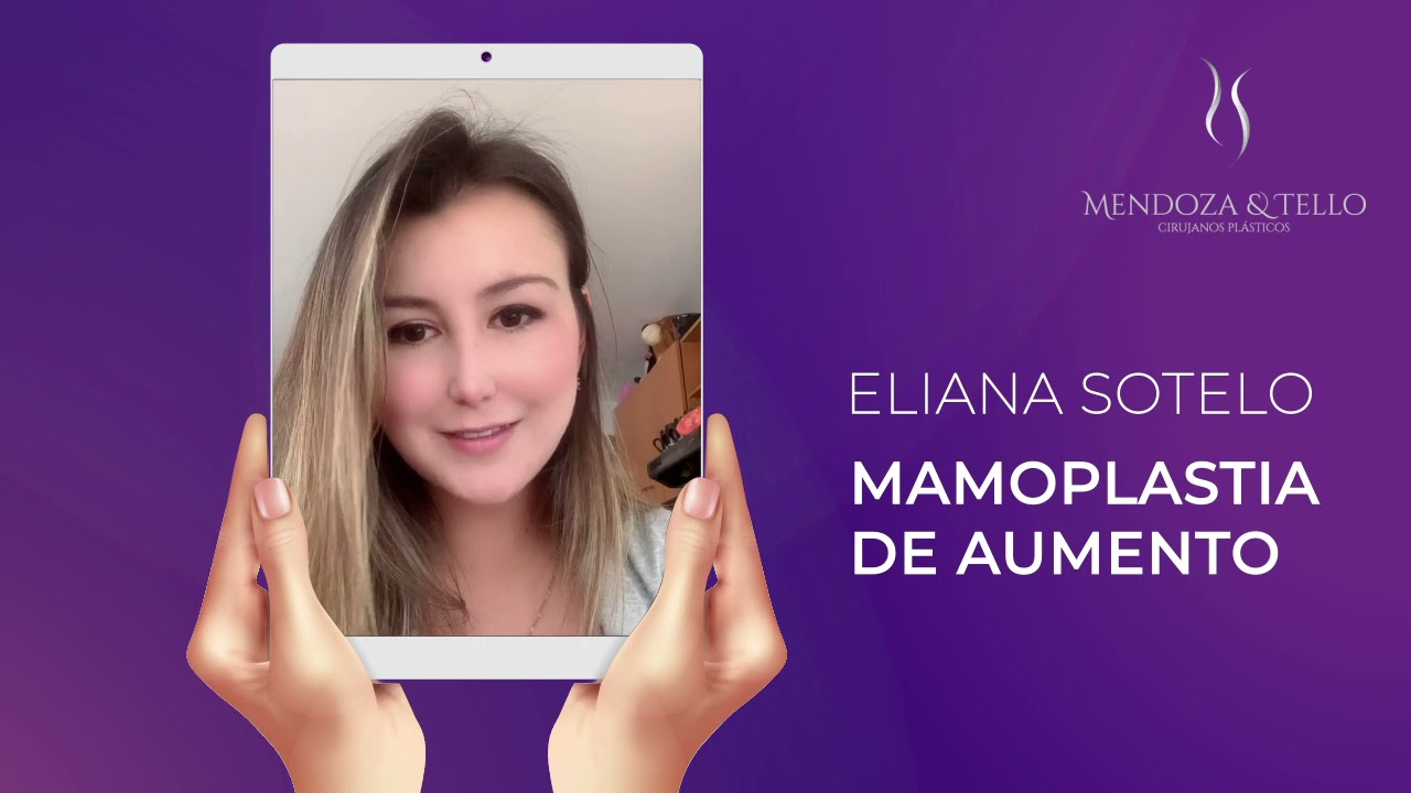 Alexander Mendoza-88