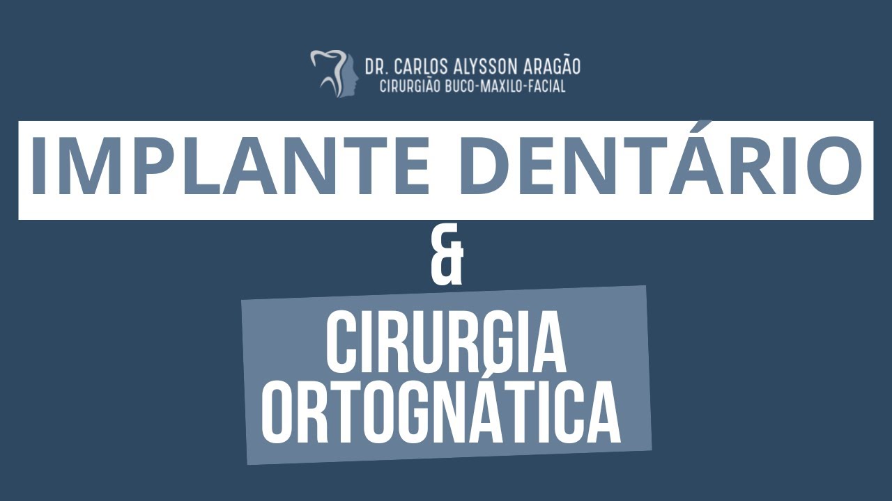 Carlos Alysson Aragão-42