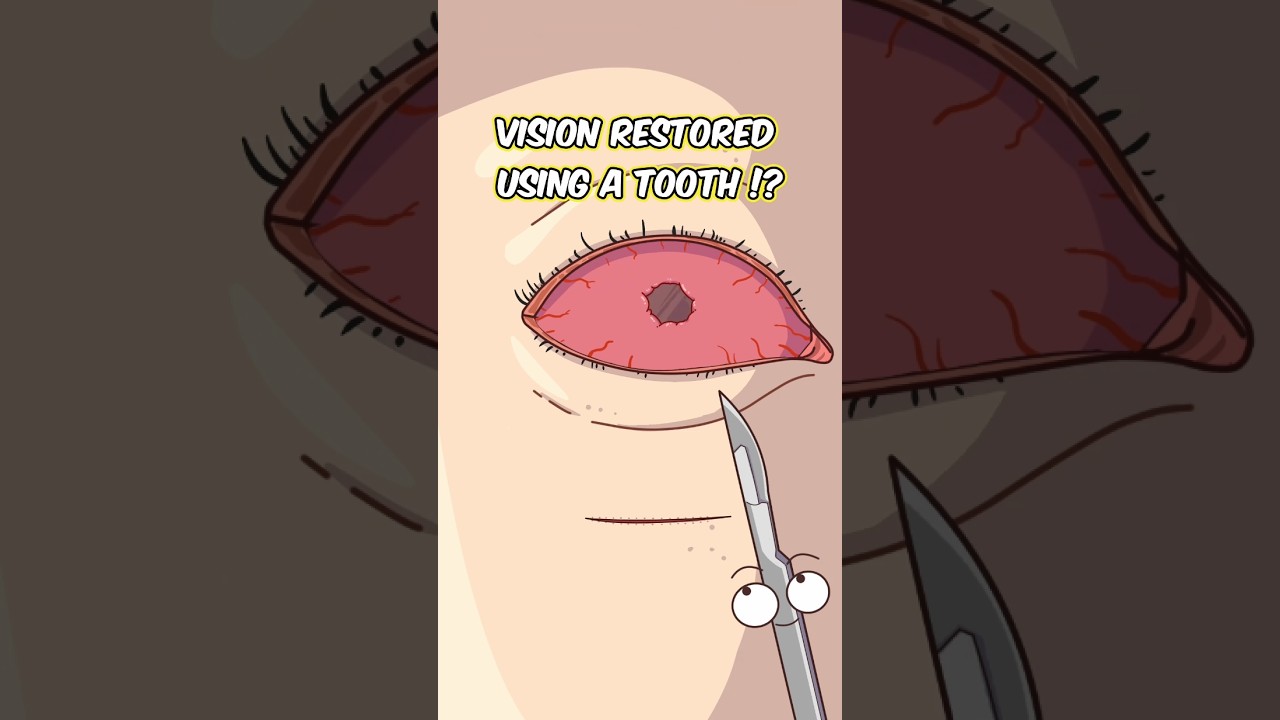 Vision Restored Using a Tooth!?