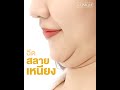 เมโสแฟต ยี่ห้อไหนดี