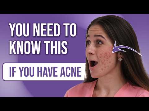 Acne: Causes, Types & Triggers