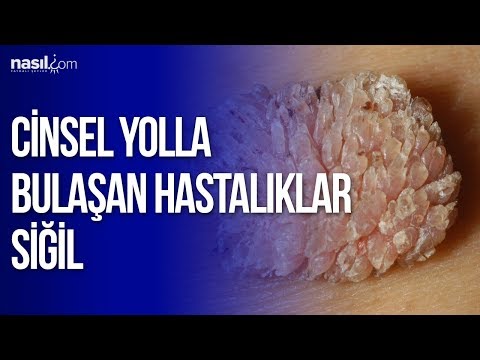 a condyloma tüneteit jelzi