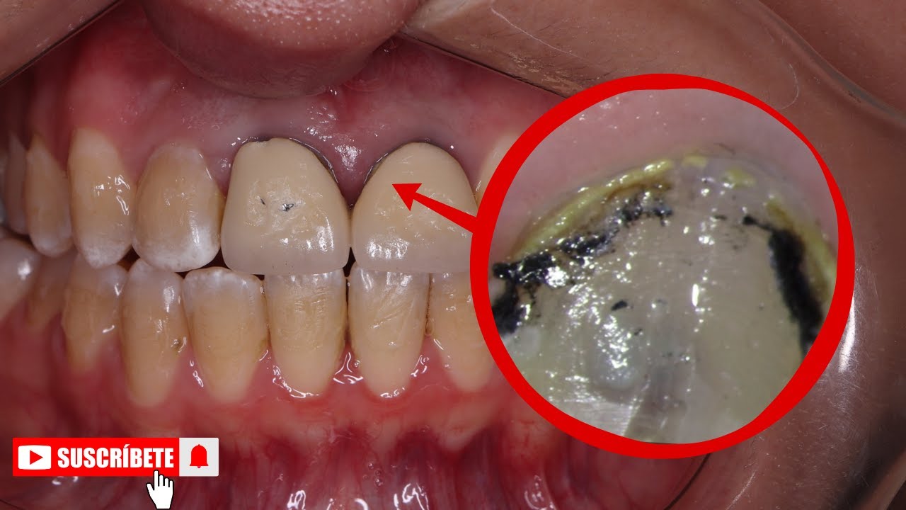 Cecilia Lopez Campa-15