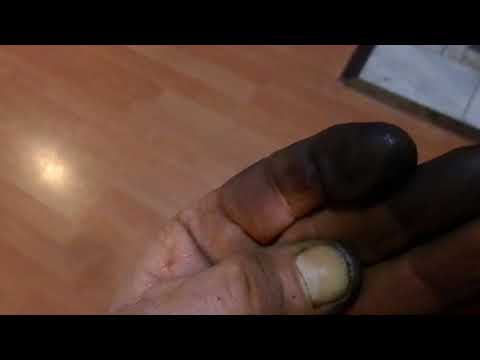 download lagu mp3 mp4 How Do You Get Walnut Stains Off Hands, download lagu How Do You Get Walnut Stains Off Hands gratis, unduh video klip How Do You Get Walnut Stains Off Hands