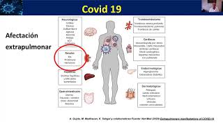 Insuficiencia renal aguda en la infección por Coronavirus Sars-Cov2 (COVID-19)